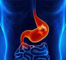 Sângerare gastrointestinală: simptome, diagnostic, îngrijire de urgență