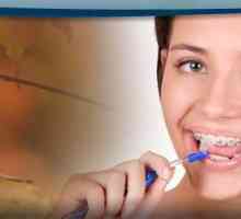 Periuța de dinți pentru paranteze: tipuri și reguli de utilizare