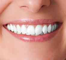 Implanturi dentare: argumente pro și contra. Implanturi dentare: preț, recenzii