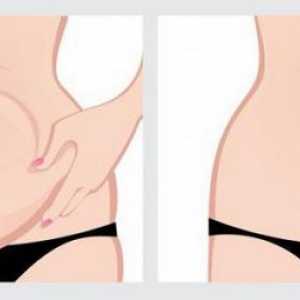 Abdominoplastia (plastic abdominal): indicații, contraindicații, descrierea procedurii, recenzii