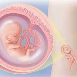 Avortul la săptămâna a 10-a de sarcină: unde să faci, consecințele