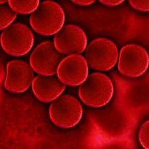 Aglutinarea sangvină este ... Grupele de sânge și reacțiile de aglutinare