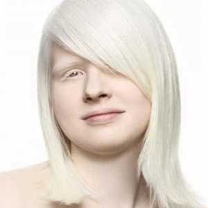 Albinos sunt ... Albinismul este o absență congenitală a pigmentului de melanină