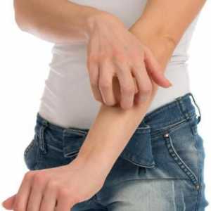 Alergii pe picioare și mâini: cauzele, simptomele și caracteristicile tratamentului