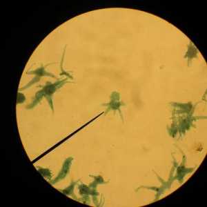 Ameba Proteus: clasă, habitat, fotografie. Cum protejează amoeba proteus?