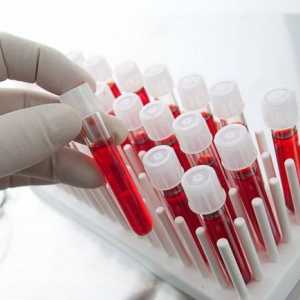 Test de sânge pentru cancer. Este posibilă determinarea cancerului prin analiza sângelui?