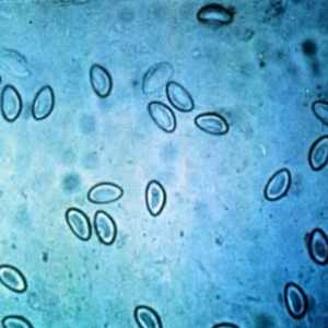 Analiza pentru enterobioză: cum se face eșantionarea materialului de cercetare