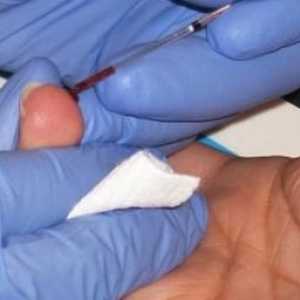 Analiza UAC și a altor tipuri de teste de sânge