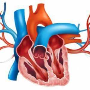 Aorta este compactată - ce înseamnă? Tratamentul compactiilor aortice