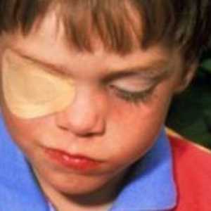 Tratamentul ochilor pentru copii la copii: o descriere a procedurii, eficacitatea și feedback-ul