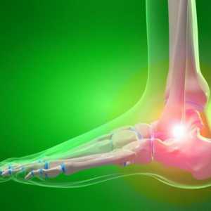 Osteoartrita gleznei: simptome și tratament. Cauzele și prevenirea artrozei gleznei