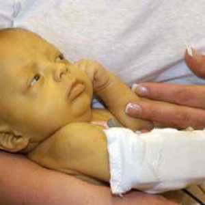 Bilirubina: norma la nou-născut. Tabel de luni