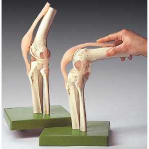 Durerea din genunchi din exteriorul lateral: tratament, cauze