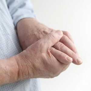 Durere în articulațiile din degete: cauze, tratament