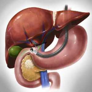 Boli ale ficatului și ale pancreasului: simptome, tratament