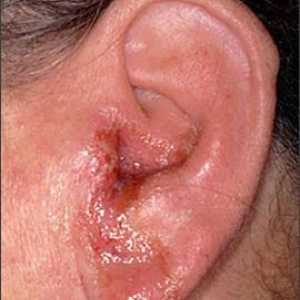 Boli ale urechii oamenilor: simptome și tratament