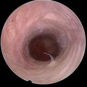 Canalul de col uterin - ce este și care sunt funcțiile sale?
