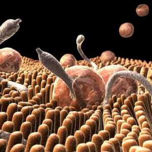 Viermi în corpul uman: semne și surse de infecție