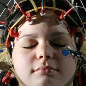 Что показывает электроэнцефалограмма головного мозга? Ход процедуры, описание, назначение и отзывы