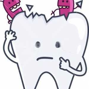 Care este etanșarea dinților? Etanșarea dinților la copii
