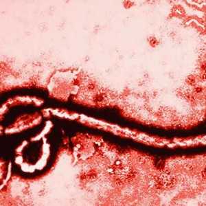 Ce este Ebola și cum se transmite virusul la om?