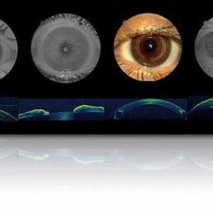 Ce este tomografia optică de coerență a ochiului?