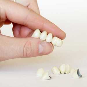 Ce este proteza dentară? Tipuri de proteze