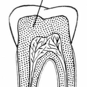 Dentin - ce este asta? Tipurile, structura, compoziția și caracteristicile tratamentului
