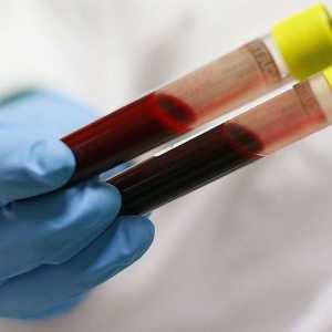 Diagnosticul bolilor. Test de sânge biochimic: ce va arăta?