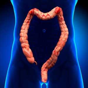 Obstrucție intestinală dinamică: clasificare, cauze, simptome și tratament