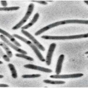 Celulele bacteriene se caracterizează prin prezența a ceea ce? Caracteristicile, structura și…