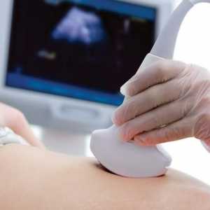 Dopplerometrie fetală: indicatori și transcripție