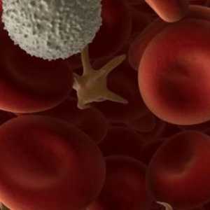 Dacă limfocitele sunt ridicate în sânge - ce înseamnă aceasta?