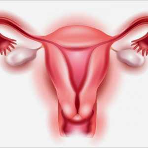Fibroamele ovariene: simptome, cauze, tratament