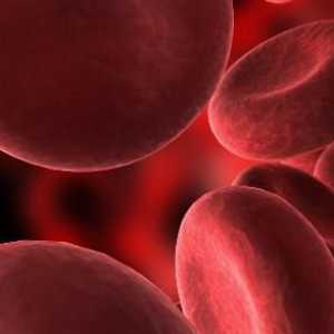 Folic de anemie: cauze, simptome, tratament