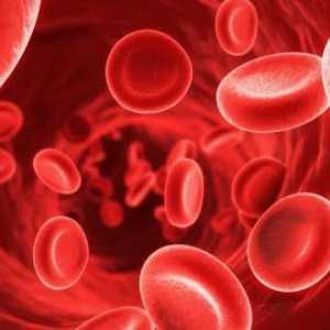 Anemia hemolitică a lui Minkowski-Schoffar: diagnostic și tratament