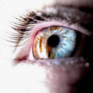 Este heterocromia la oameni o boală sau o caracteristică pătrunzătoare?