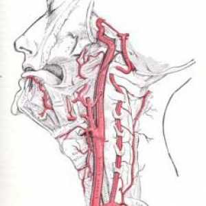 Hipoplazia arterei vertebrale stângi. Cauze. Simptome. tratament