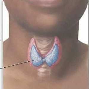 Hipotiroidismul este ceea ce?