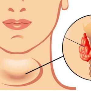 Hipotiroidismul: tratamentul și simptomele