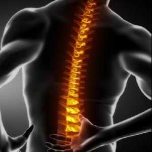 Herniationul coloanei vertebrale lombosacrale: tratament, simptome
