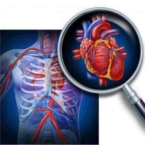 Insuficiență circulatorie cronică: clasificare, tratament