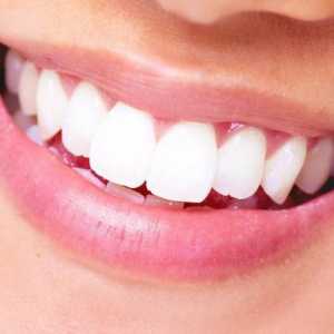 Implant sau coroană - ce este mai bine pentru dinte?