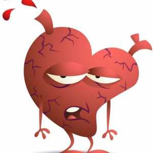 Boala cardiacă ischemică. Ce este și care sunt manifestările sale?