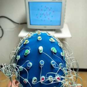 Electroencefalografia - ce este? Cum se efectuează electroencefalografia?