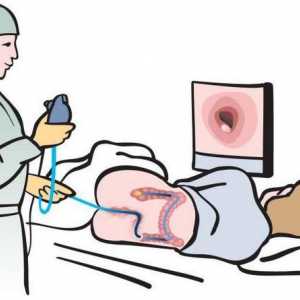 Endoscopia intestinului: ce este, descrierea procedurii, indicații, pregătire