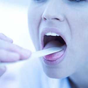 Cum să tratați laringita: metode populare și sfaturi practice