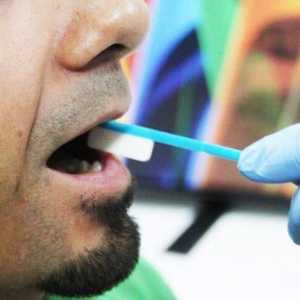 Care este numele testului de saliva? Metode de analiză