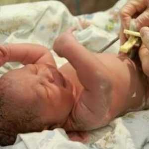 Cum să tratăm ombilicul nou-născut după descărcarea de gestiune din spital?