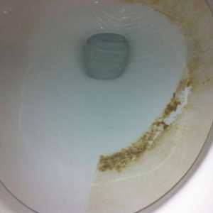 Cum de a curăța vasul de toaletă din piatră urinară?